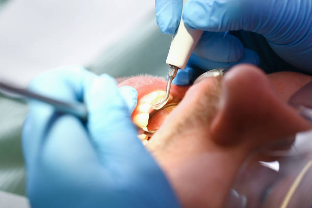 Best Urgent Care for Lost Fillings or Crowns in Clinton, IL