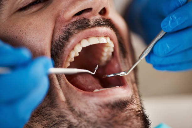 Best Emergency Gum Treatment in Clinton, IL