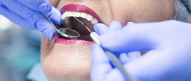 Best Emergency Denture Repair in Clinton, IL
